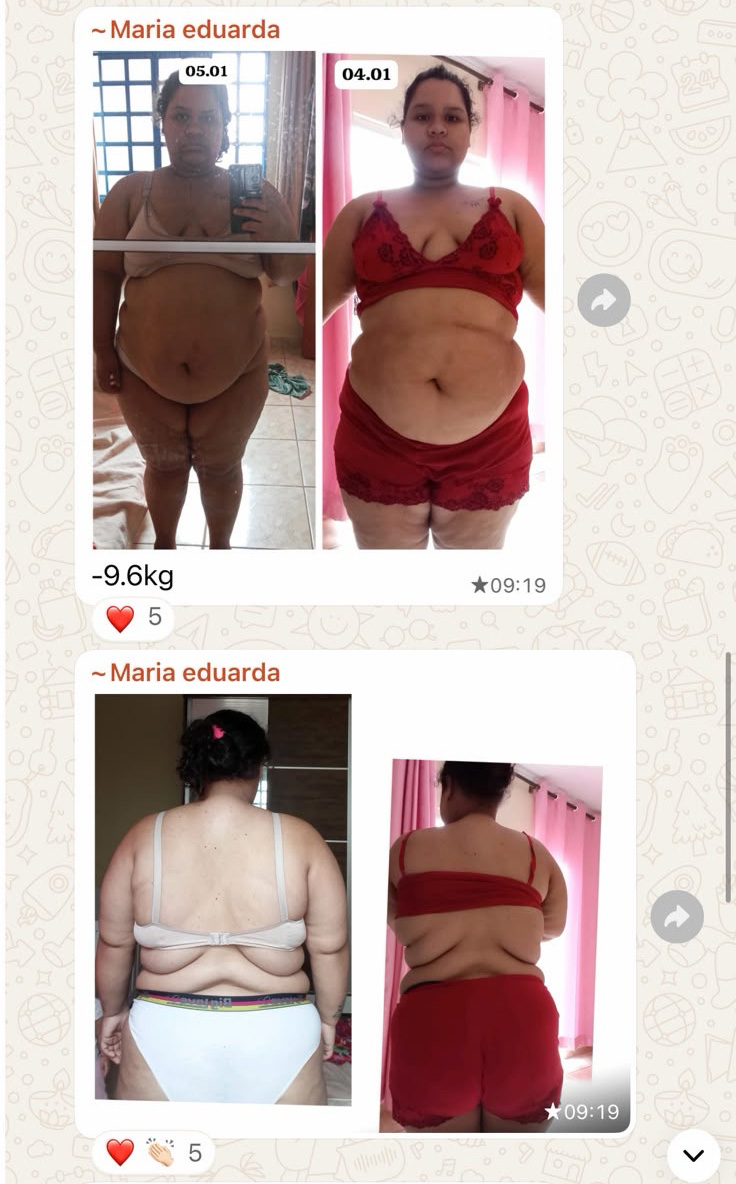 Maria Eduarda: menos 9,6kg, antes e depois